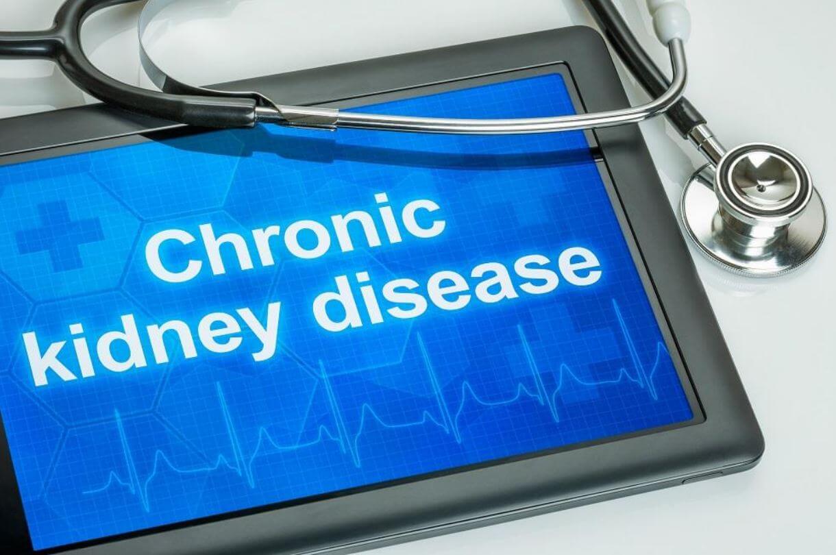 The five stages of chronic kidneydisease
